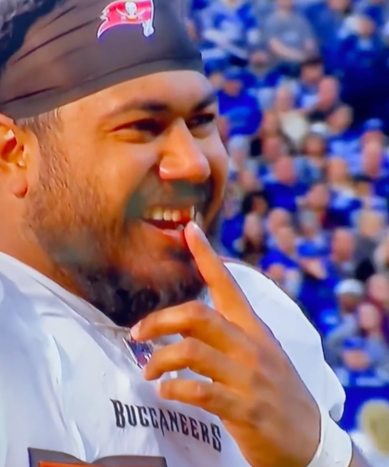 Bucs DT Vita Vea loses tooth, immediately cracks smile