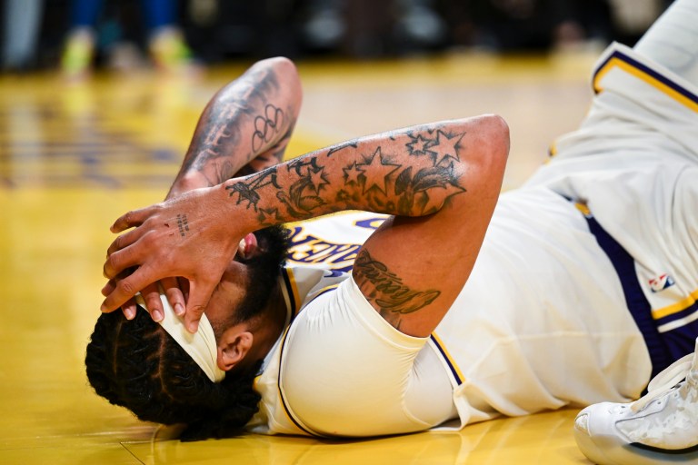 Anthony Davis Injury Update: Expected to play Wednesday vs. Grizzlies